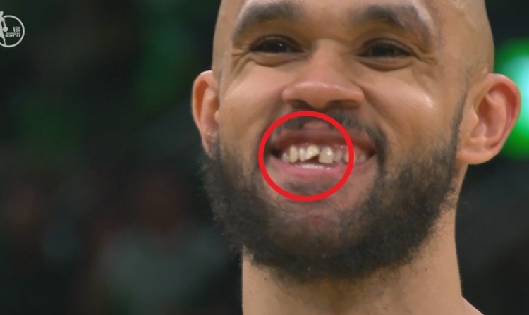 开云体育下载-小白谈去年总决赛被打门牙：之后我进了三分 是我最美好回忆之一